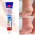 Aichun beauty moisturizing foot cream, dead skin care cream, foot removal cream for cracked heels 20g AC2042